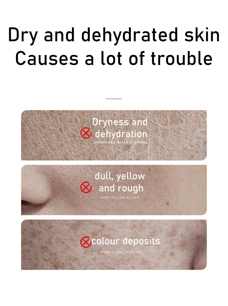 Rice Toner 70% Rice Extract Serum with Niacinamide, Rice Cleansing Foam, Deep Cleansing, Moisturizer for Dry Skin, Skin Care Set